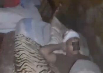 Eldorado: Esclarecen las lesiones de dos jóvenes, un accidente en moto, no una golpiza