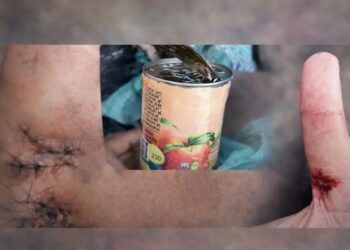 Grave accidente de un recolector obligó a modificar el servicio nocturno de residuos en Eldorado