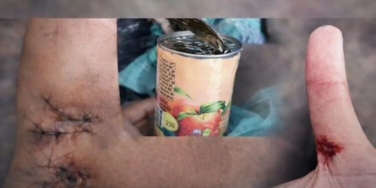 Grave accidente de un recolector obligó a modificar el servicio nocturno de residuos en Eldorado